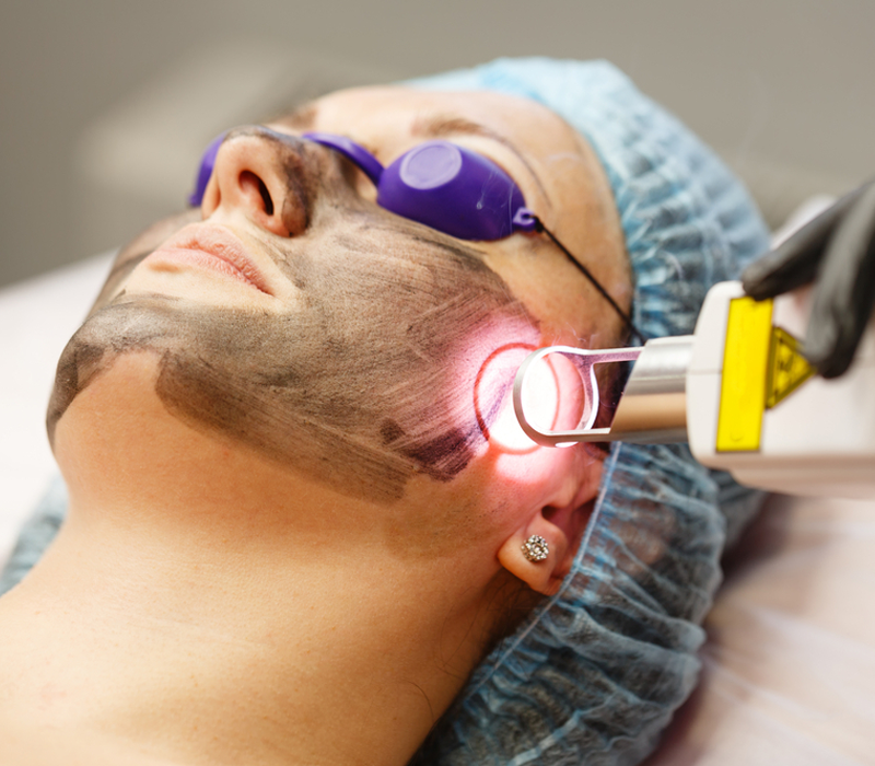face pigmentation treatment