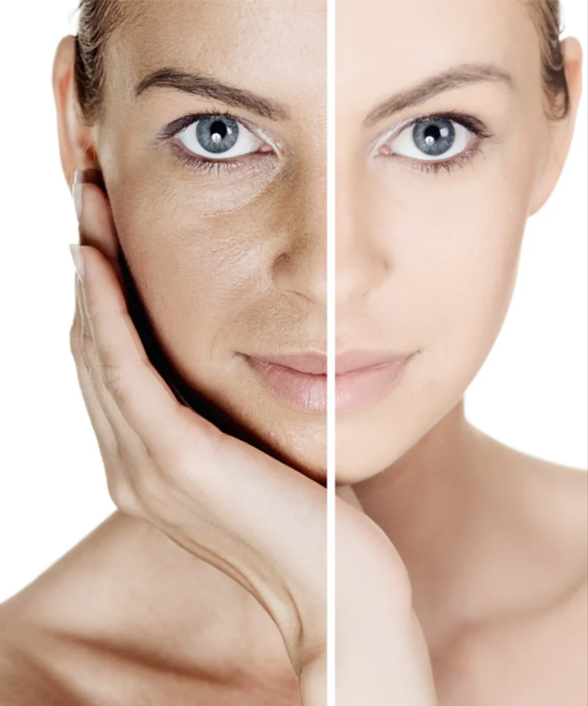 Anti pigmentation treatment Hospital Phagwara