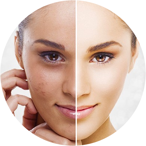 anti pigmentation treatment