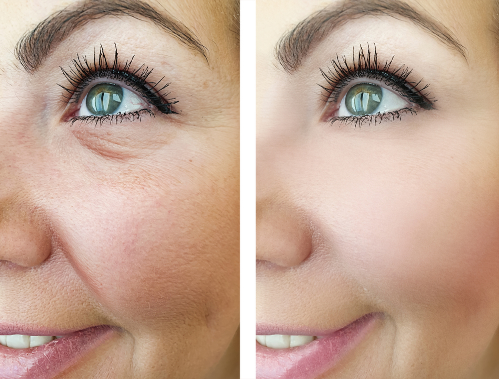 eye-aniti-banner-slide-5