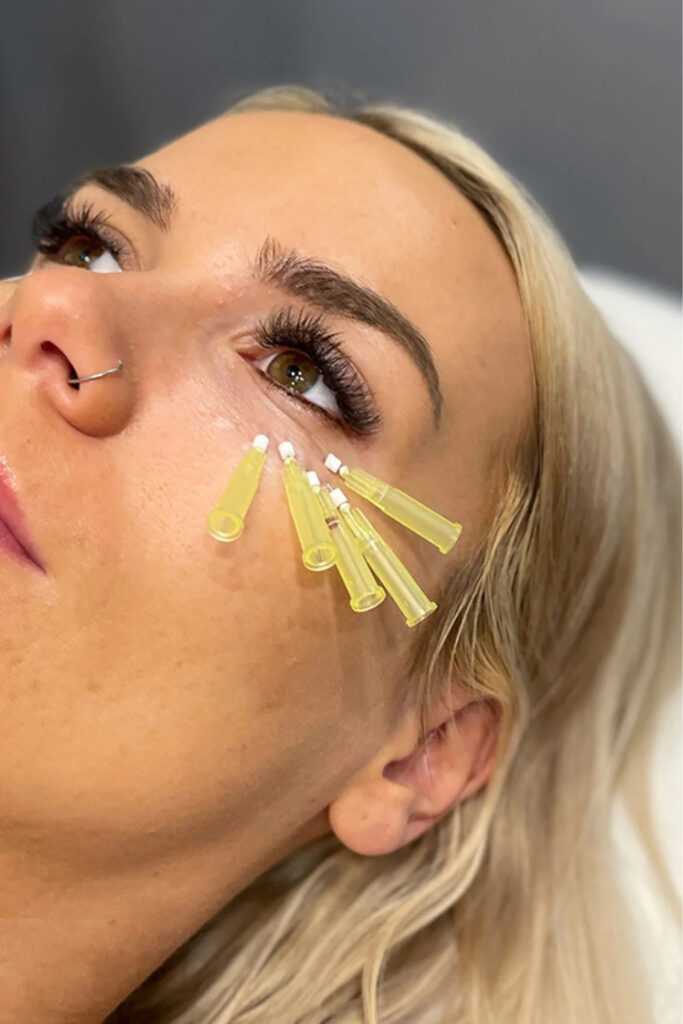 Best under eye care treatment