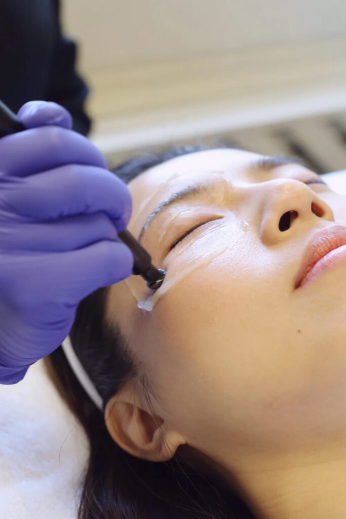 Undereye Fillers treatment