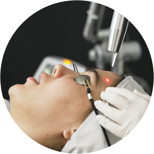 skin laser treatment in phagwara