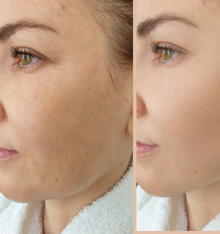 Best Pigmentation Clinic Near me