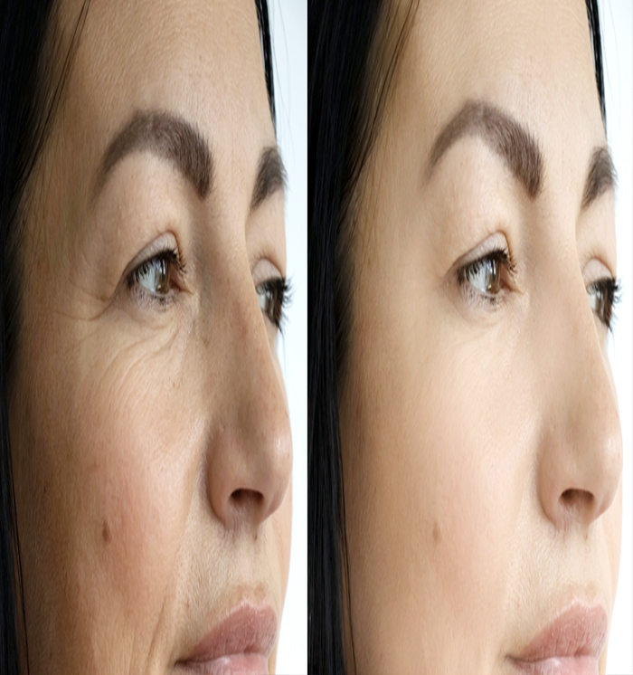 pegmentation-banner14