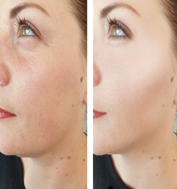 best anti pigmentation treatment in Phagwara